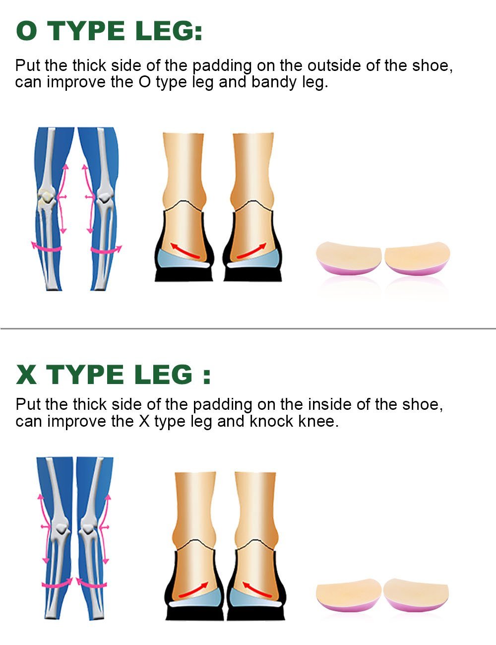 OX Type Leg Heel Inserts Orthopedic Insole Perfect Halfsphere Design for Bowlegs and Knock Knees
