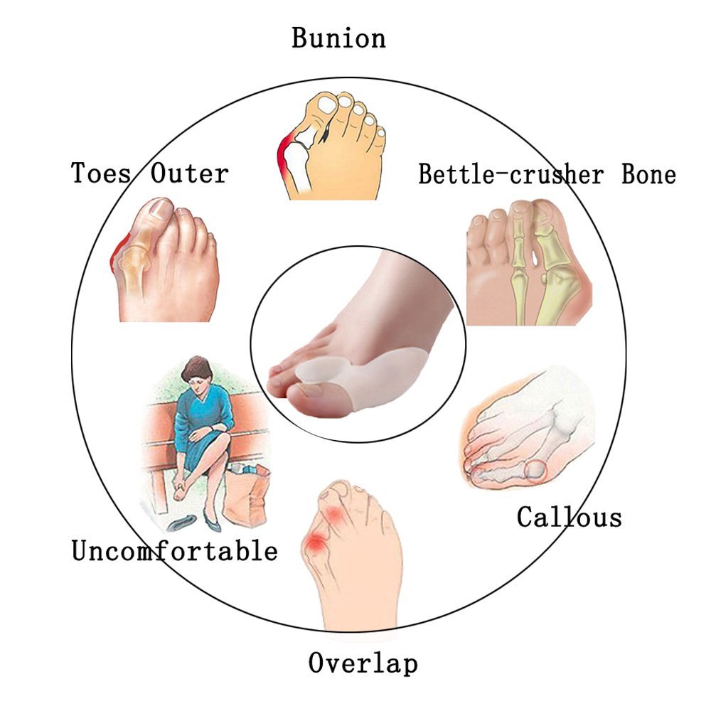 Medicus Hallux Valgus Pro Toe Separators for Bunion Protectors