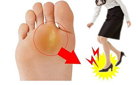Wholesale Gel Hallux Valgus Bunion Orthosis Corrector for High Heel