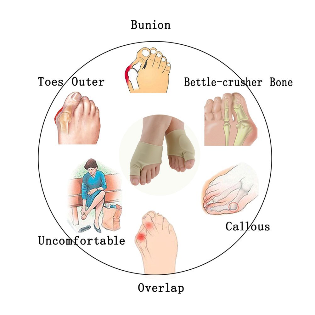 Wholesale Gel Hallux Valgus Bunion Orthosis Corrector for High Heel