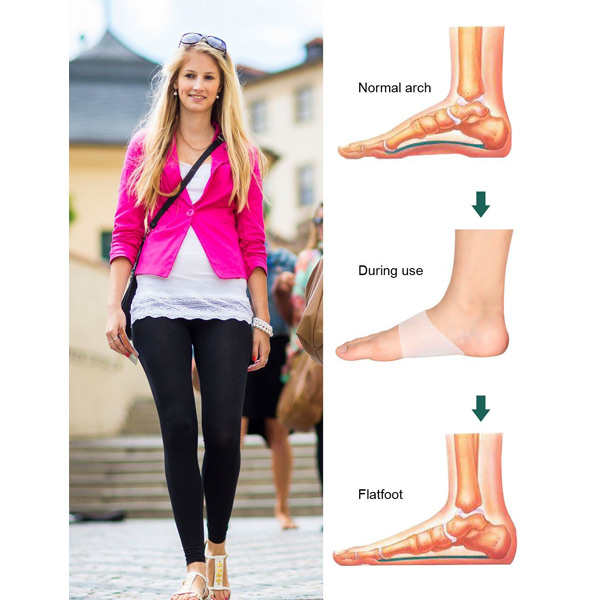 arch sleeves for flat feet